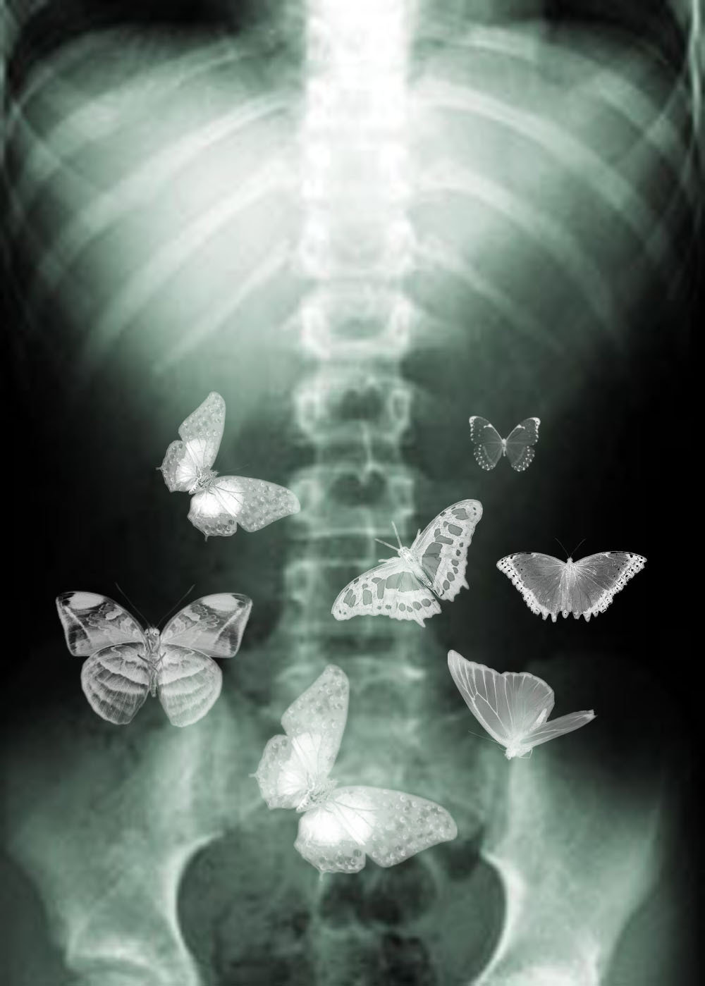 butterflies_in_my_stomach_by_Bee_ee